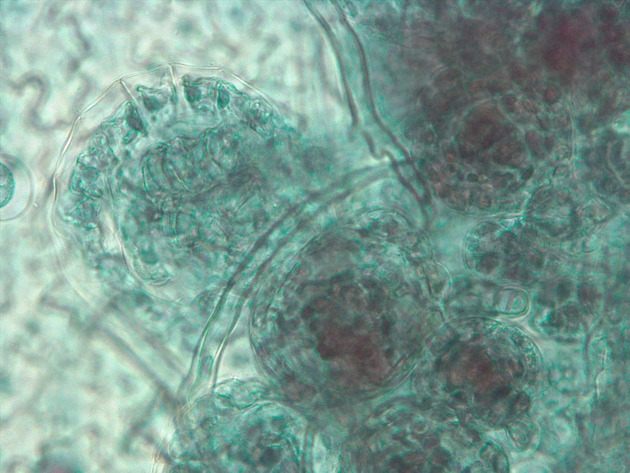 Fern Sori Slides - Fern Sori 01 400X
